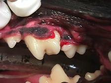 damaged tooth following cleaning
