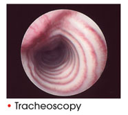 Tracheoscopy