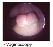 Vaginoscopy
