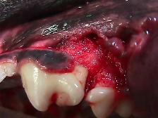 Preparing A Skin Flap For Above Tooth For Repair