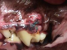Healing Gum Over Damaged Tooth Two(2) Weeks Later
